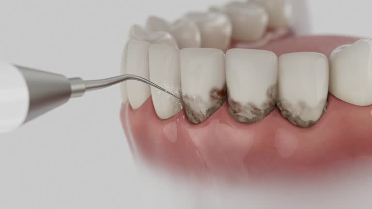 Reliable Wisdom Tooth Removal contractor in Hancock County County, MS by Dentist Open Now